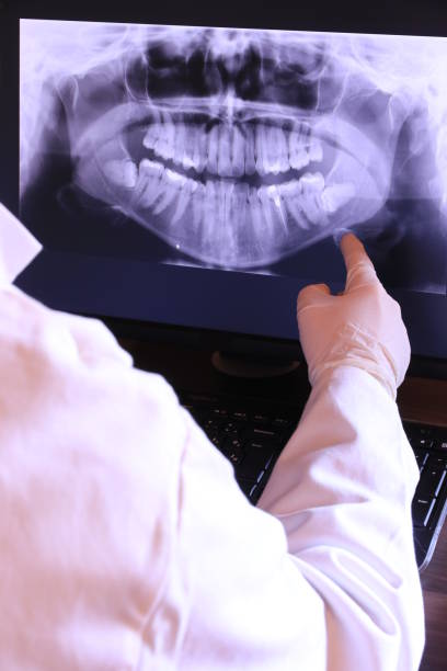 Best Emergency Tooth Extraction in Olympia, WA