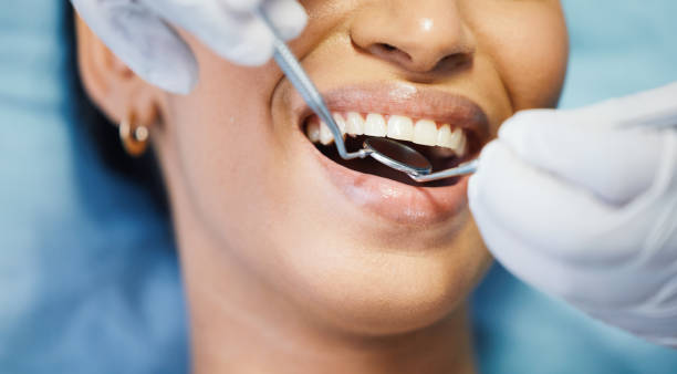 Best Emergency Treatment for Toothache in Olympia, WA